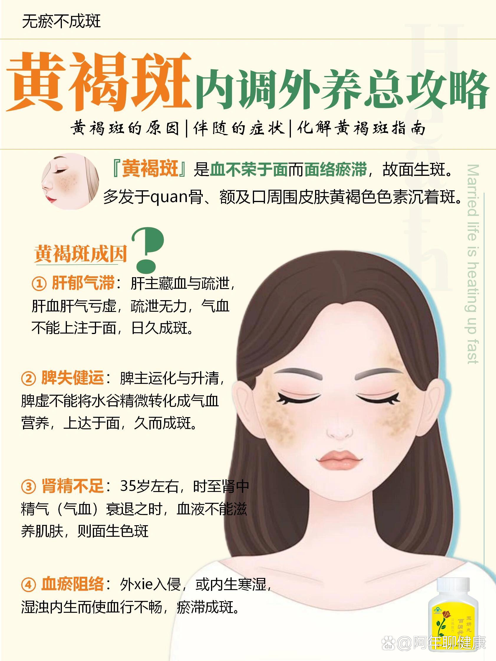 脸上长了黑斑怎么办?