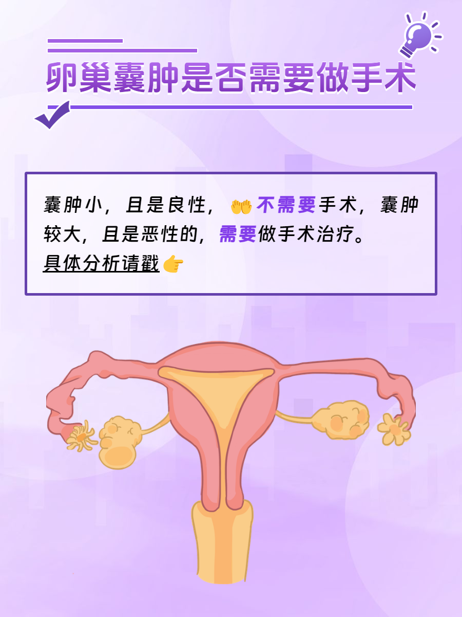 什么是附件囊肿?