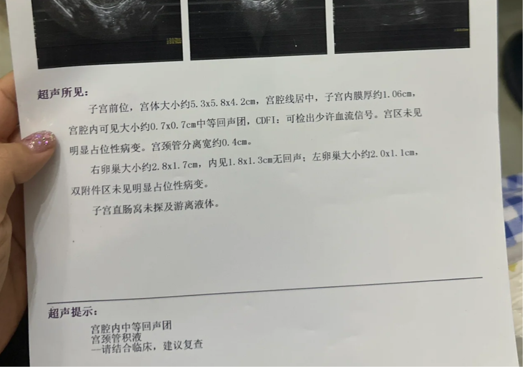 人流后出血很少怎么回事?