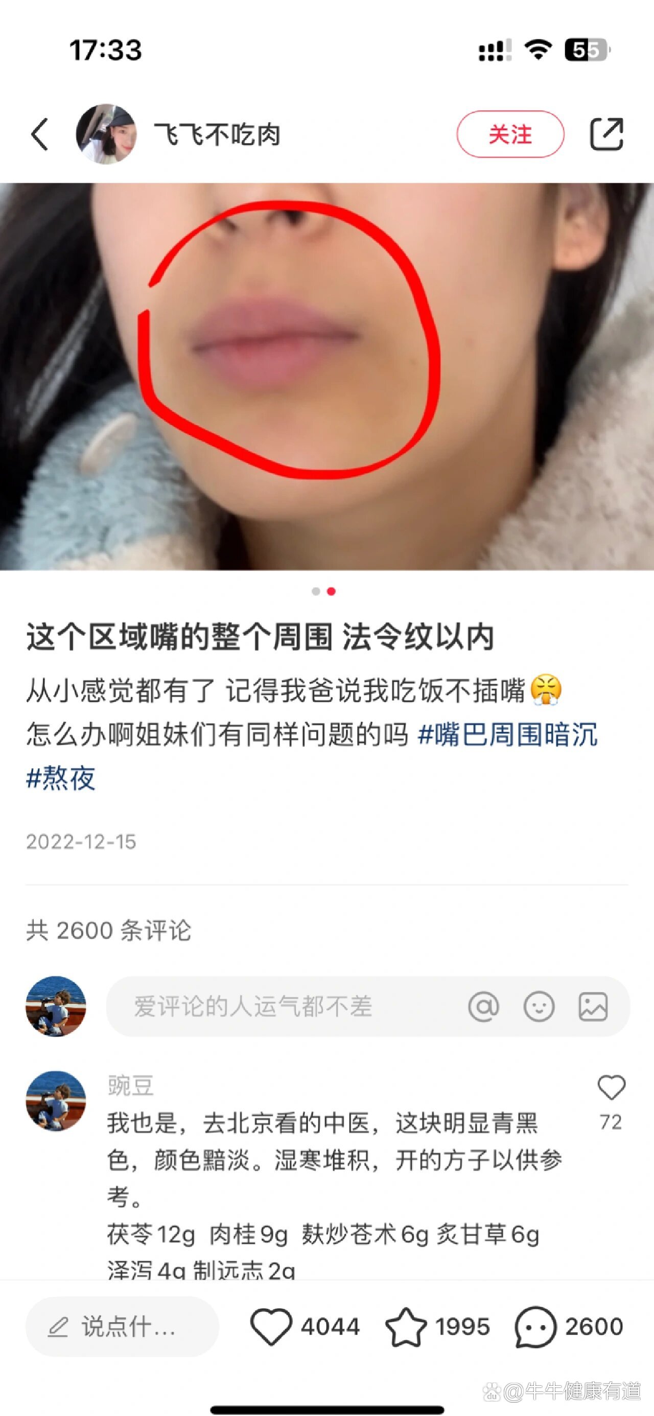 两侧嘴角发黑是为什么..