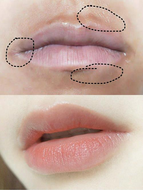 两侧嘴角发黑是为什么..