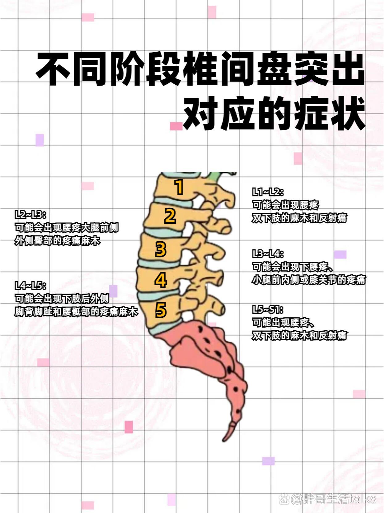 腰椎间盘突出能复位吗?