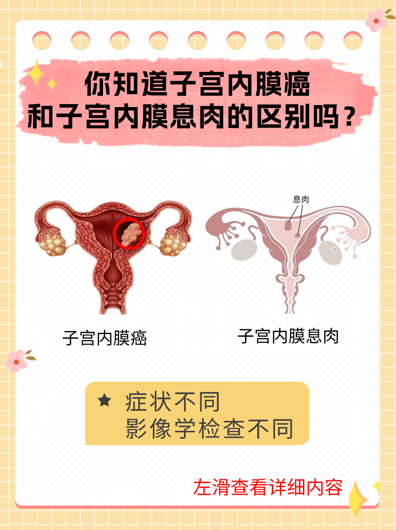 内膜息肉癌变的前兆有哪些?