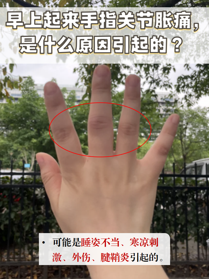 手指关节粗怎么能变细?