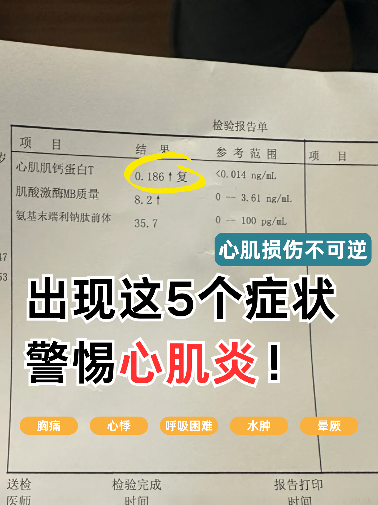 重症心肌炎的症状