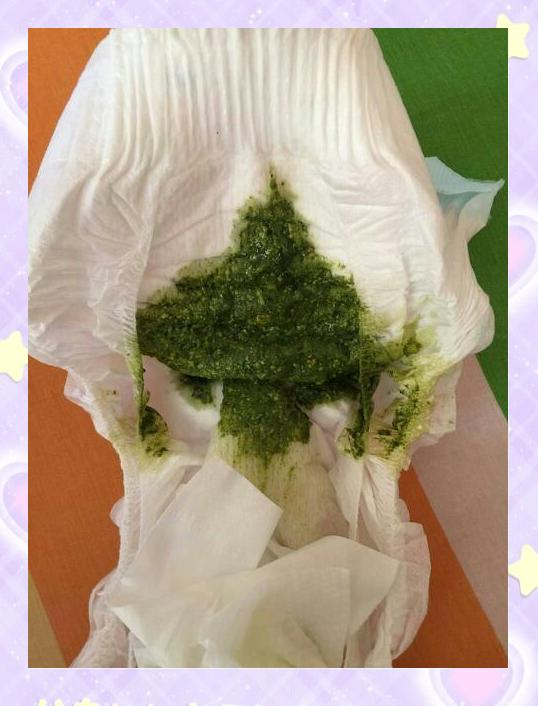 宝宝拉绿色大便,怎么回事