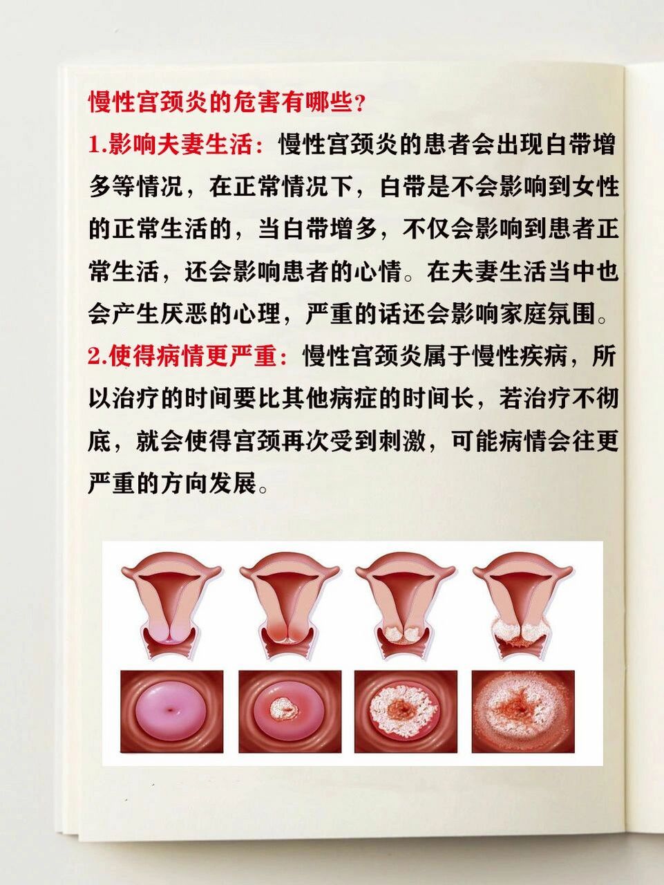 宫颈炎的主要症状有哪些