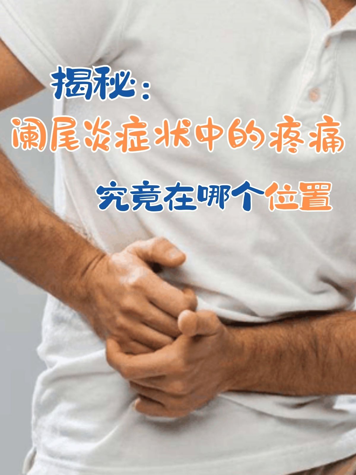 急性阑尾炎症状有哪些