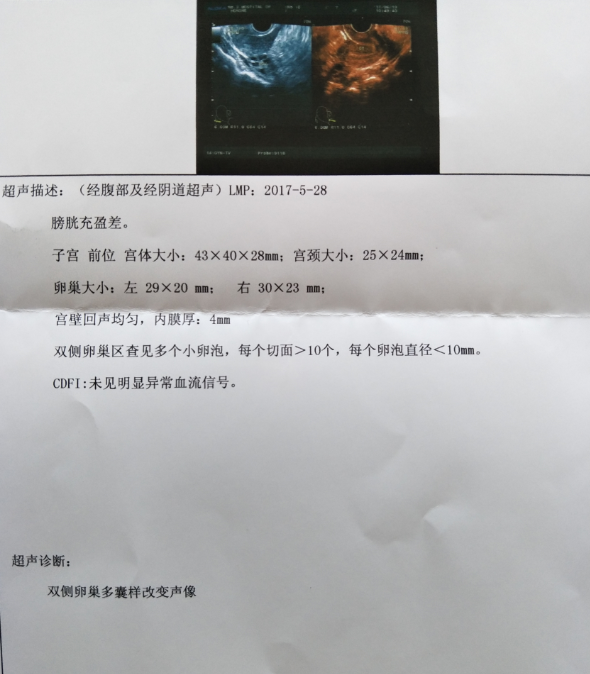 月经推迟10天测了没怀孕