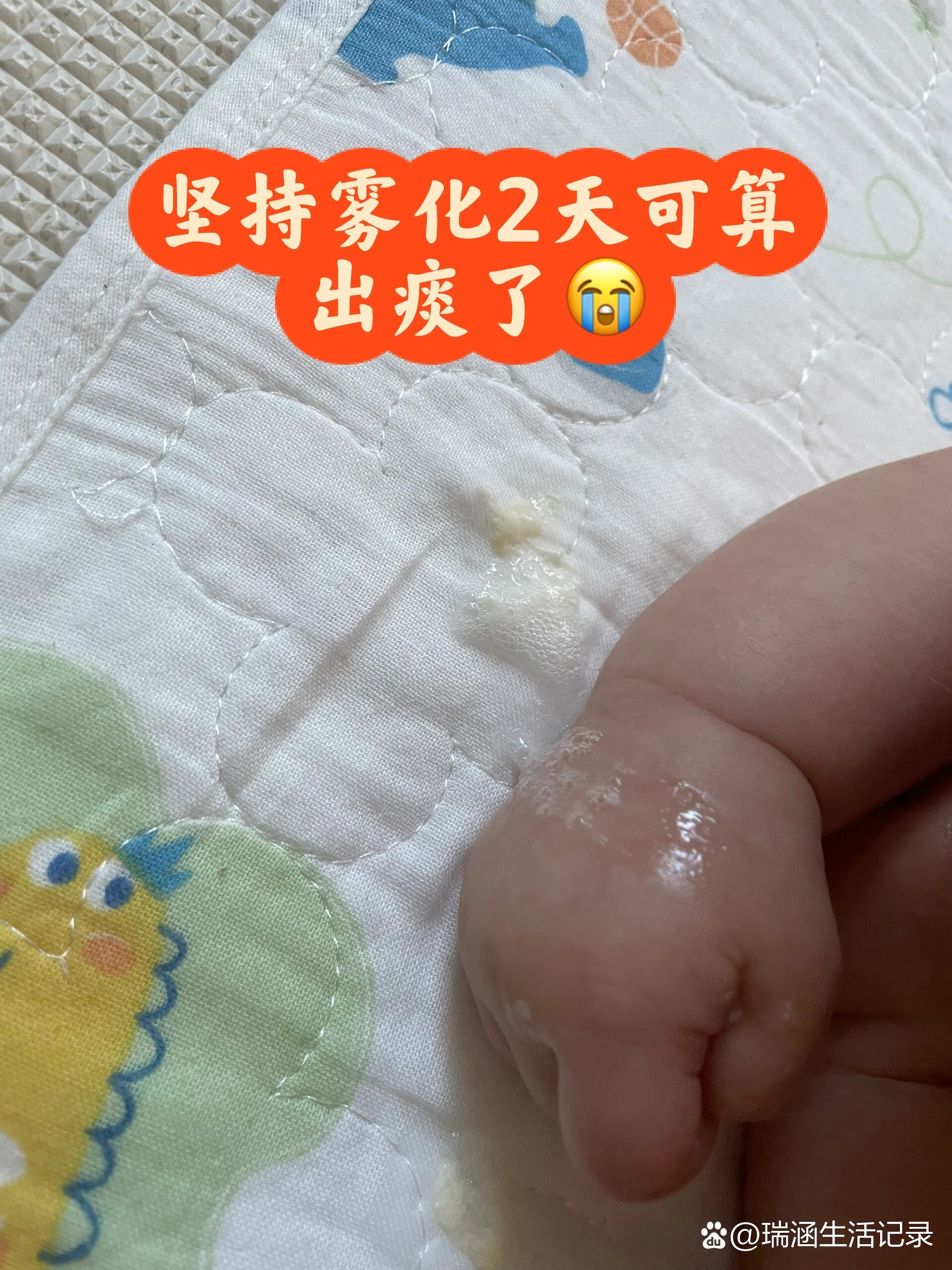 一个月的婴儿嗓子里有痰怎么办