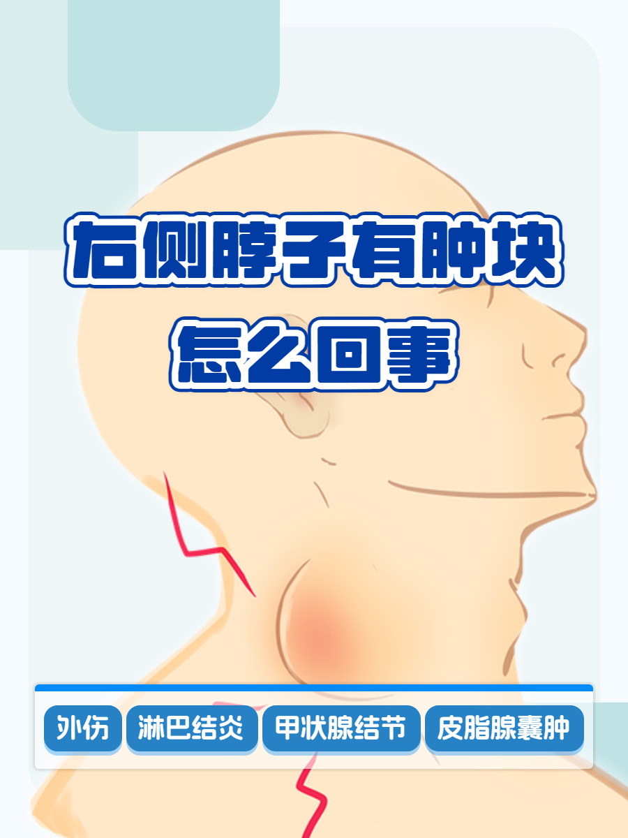 脖子上长了一个硬包!开始有点痛