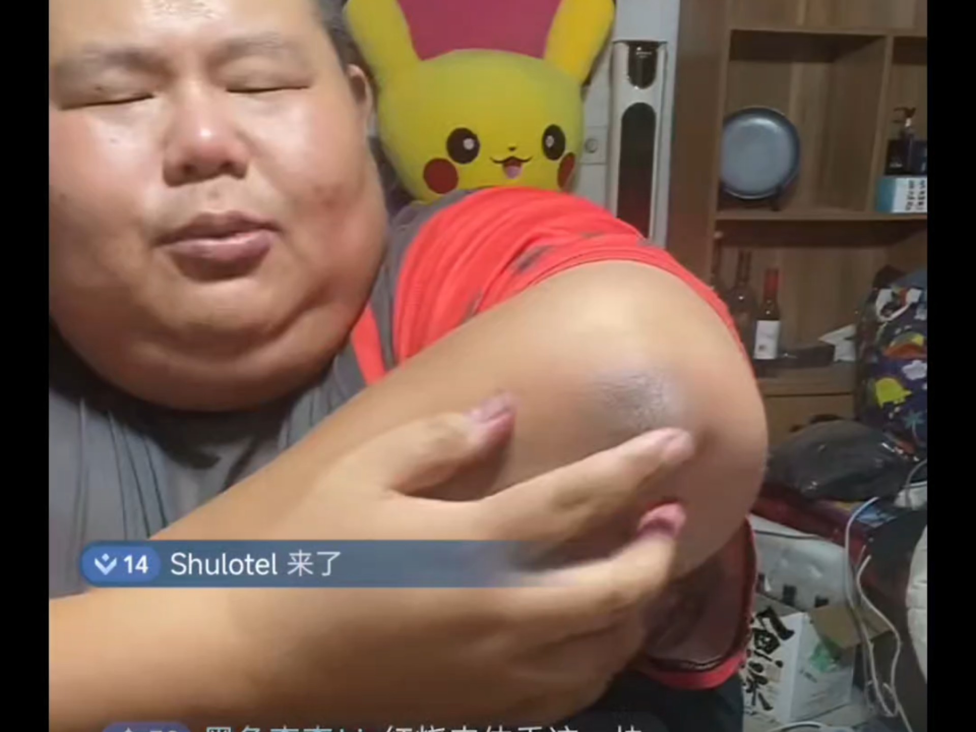胳膊肘黑怎么办