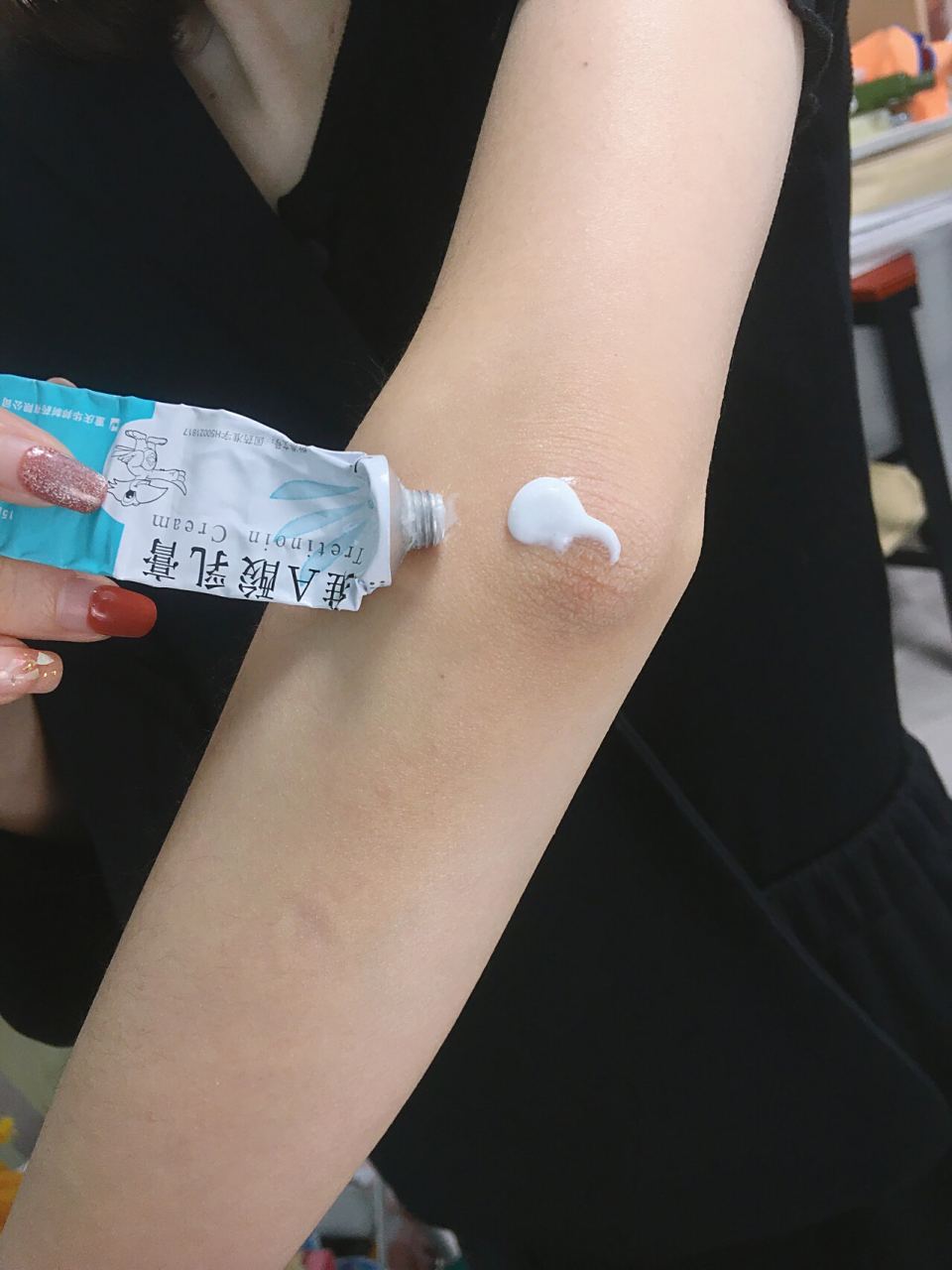 胳膊肘黑怎么办