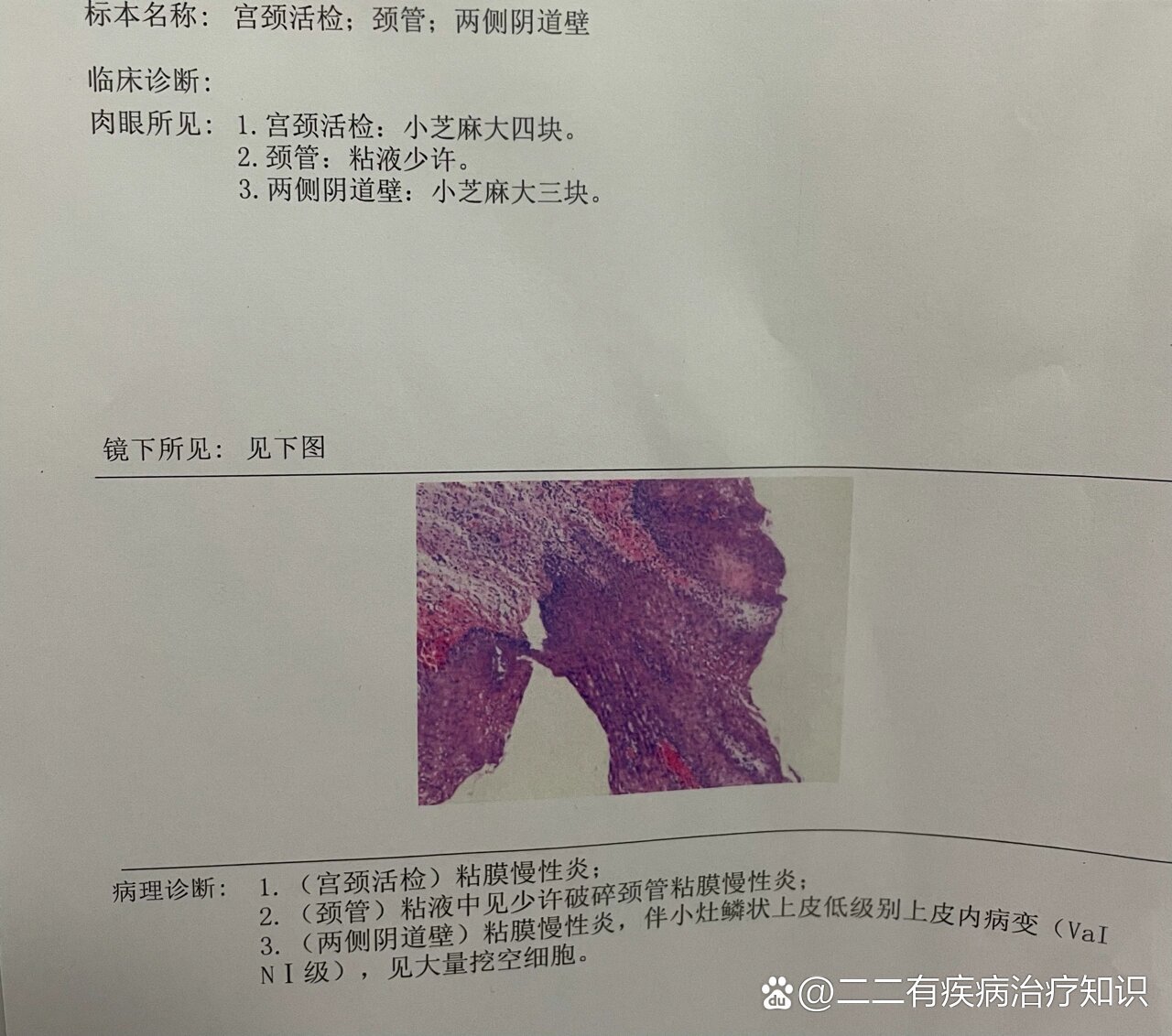 高危后三周四周六周阴可以脱恐了么