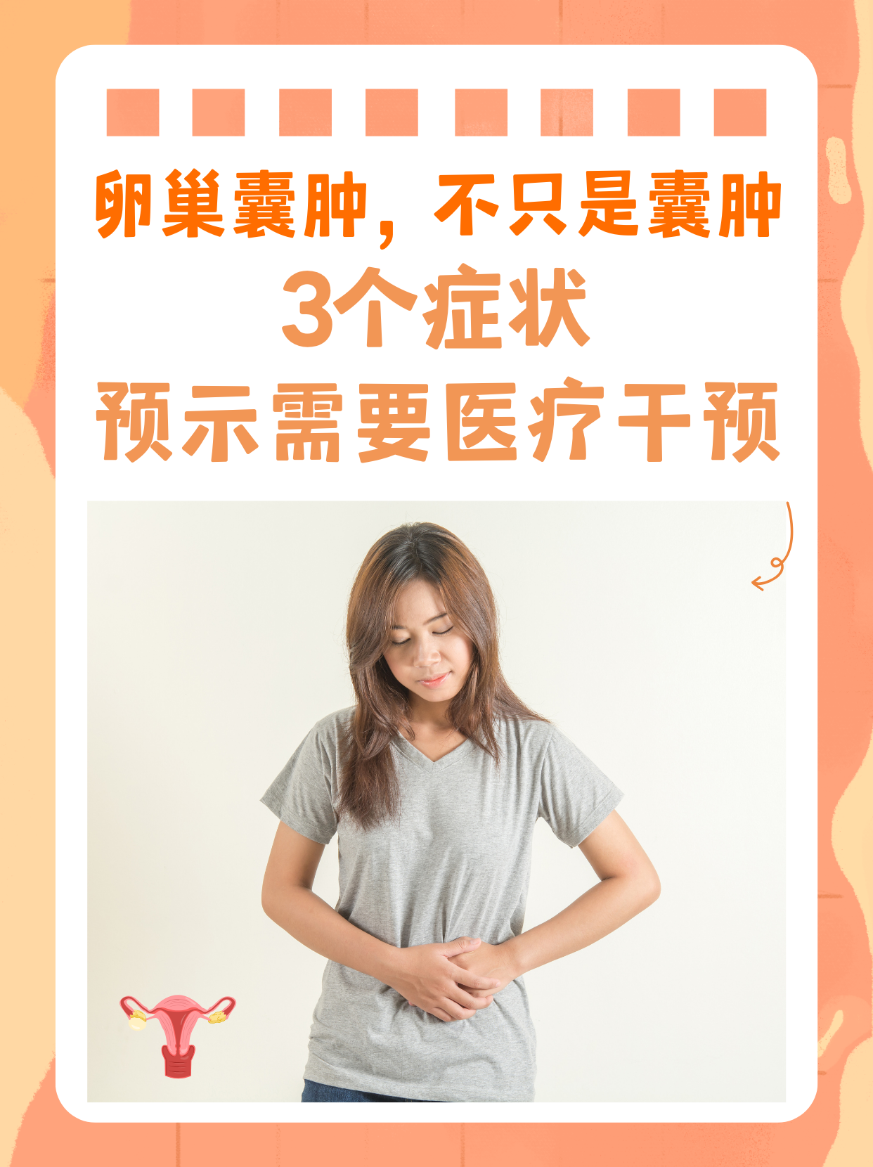 附件囊肿有什么症状