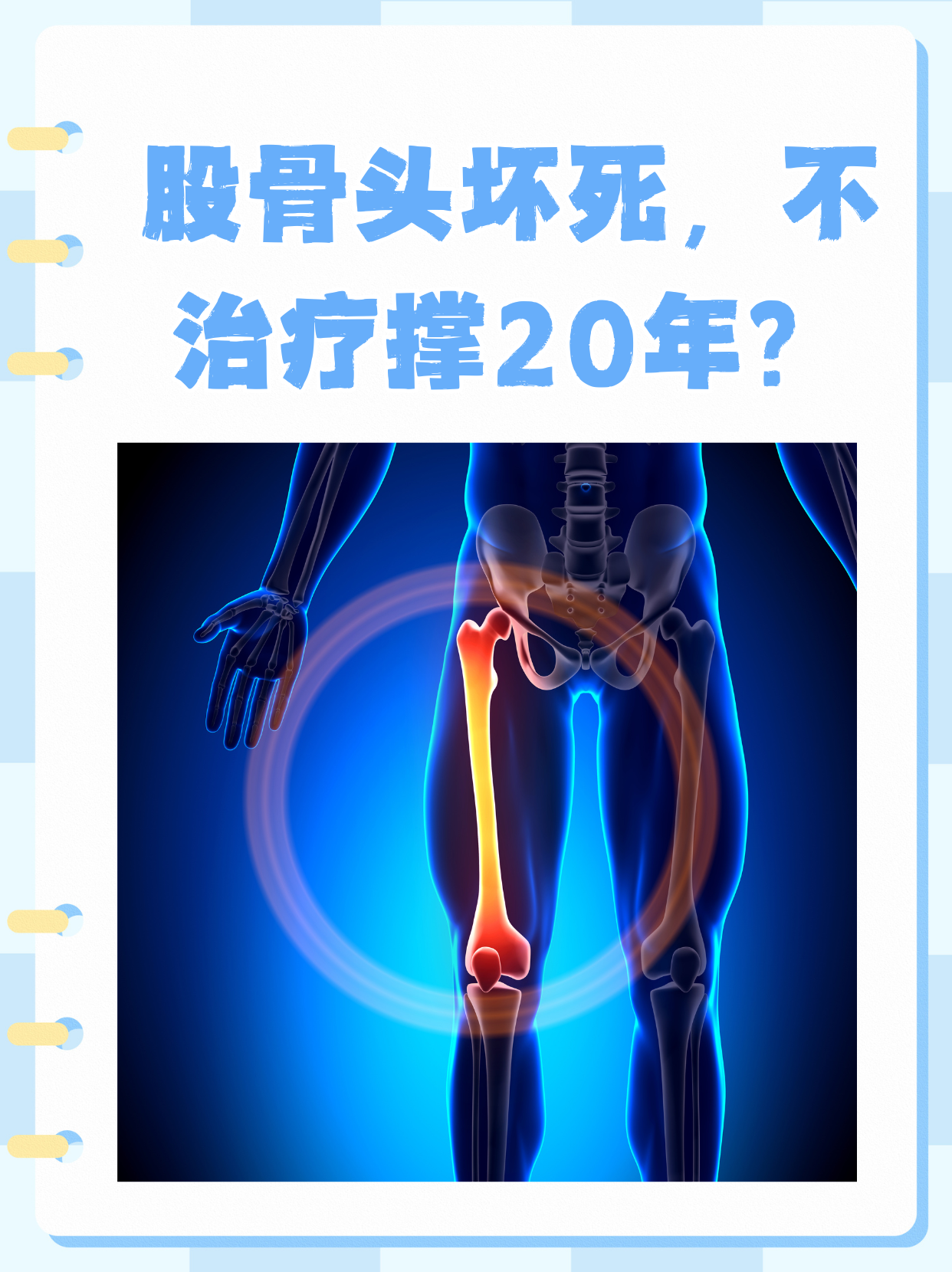 股骨头坏死的症状有些什么