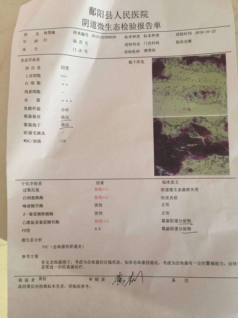 白带常规清洁度三度严重吗
