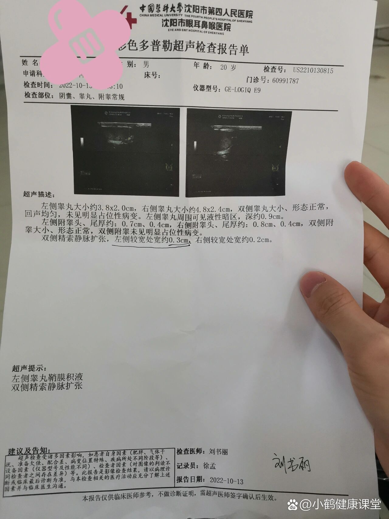 精索静脉曲张手术后多久可以恢复正常