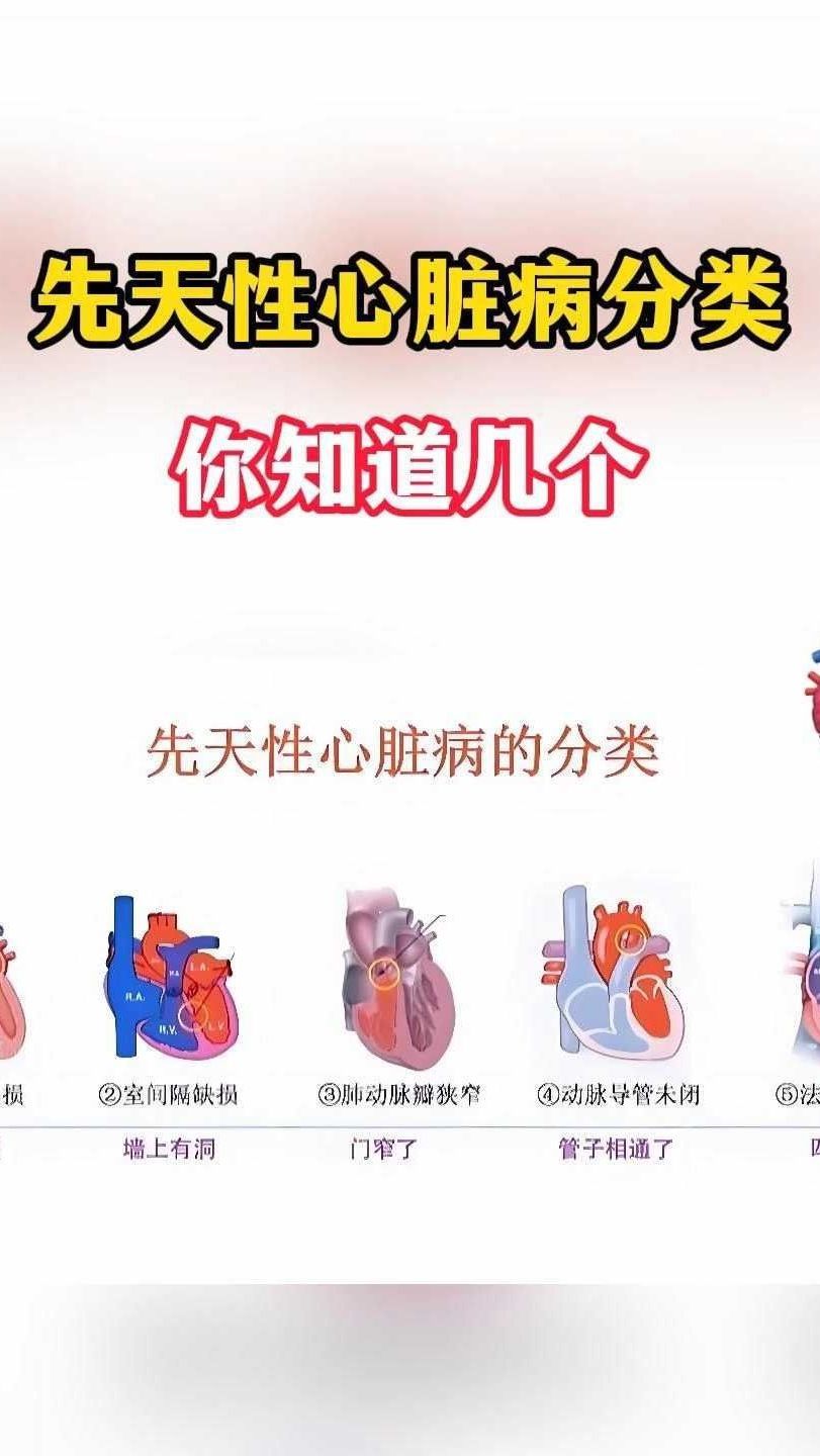 遗传性心脏病