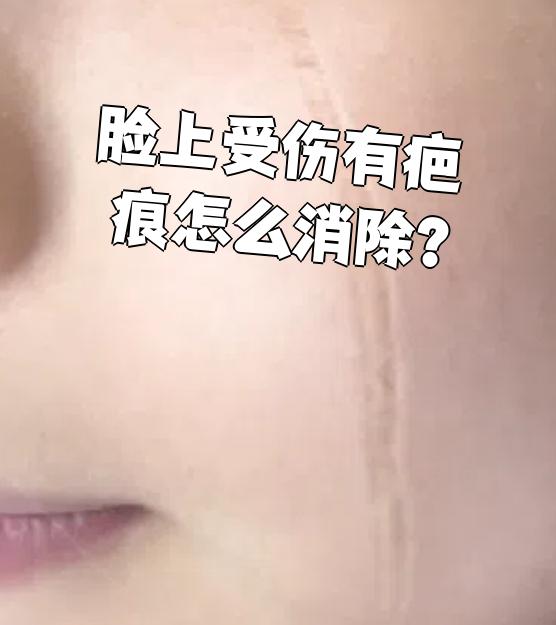脸上的疤痕如何去除