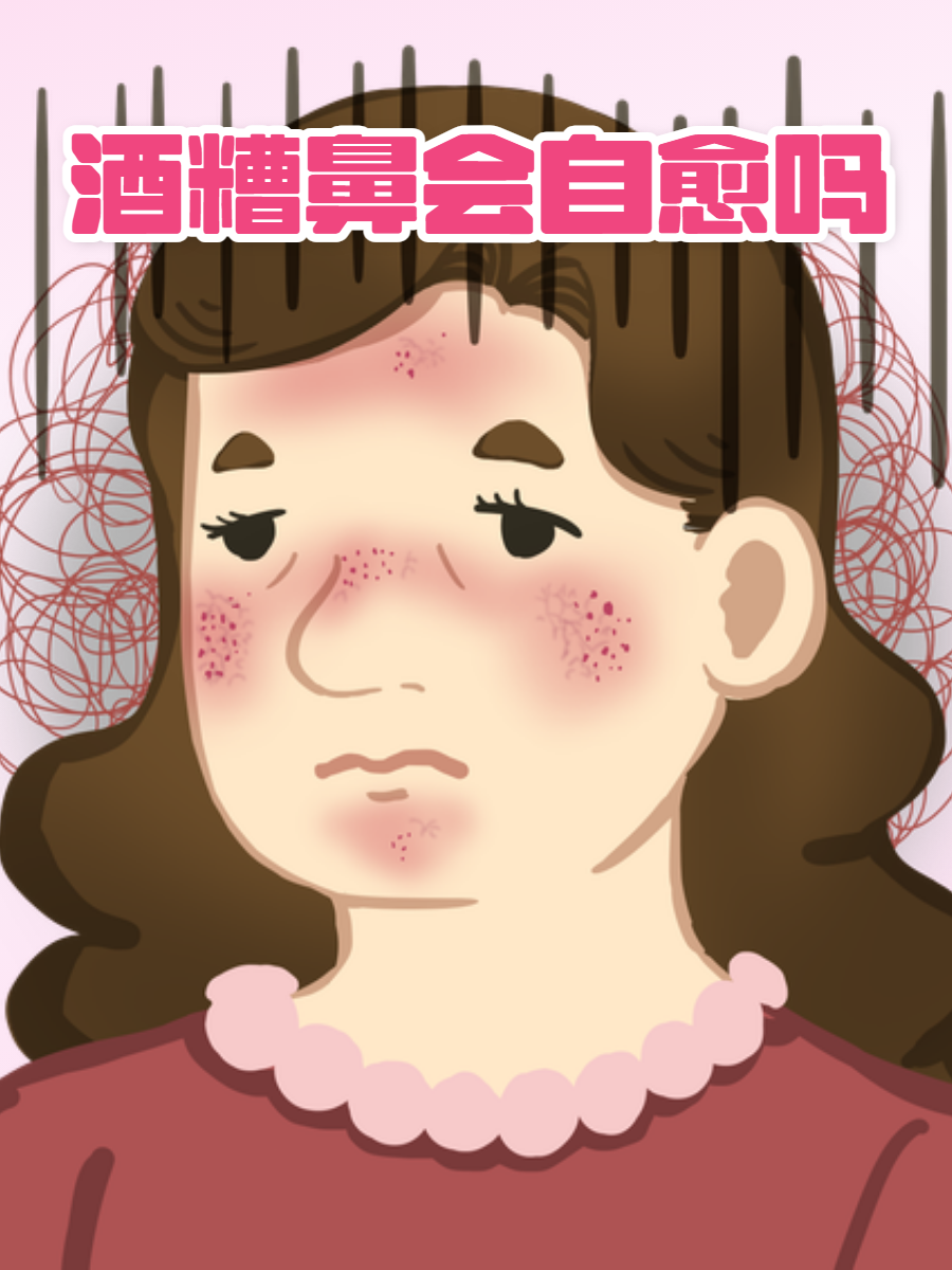 什么是酒糟鼻?