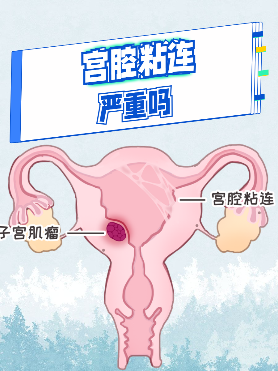 宫腔粘连有哪些表现