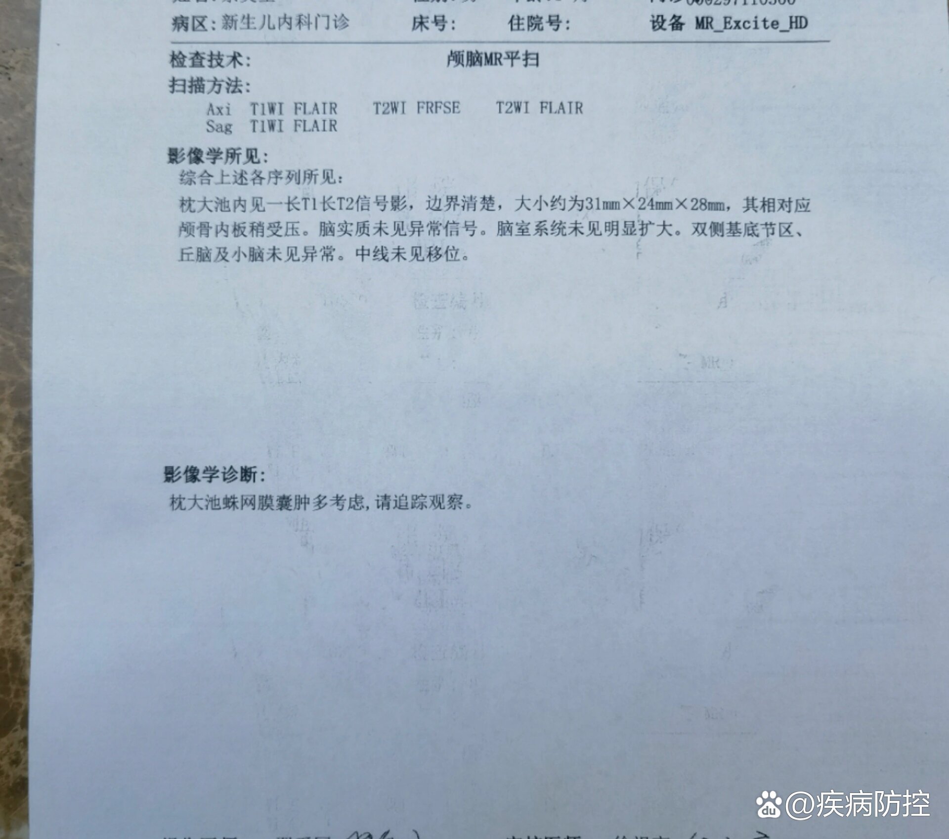 枕大池囊肿严重吗