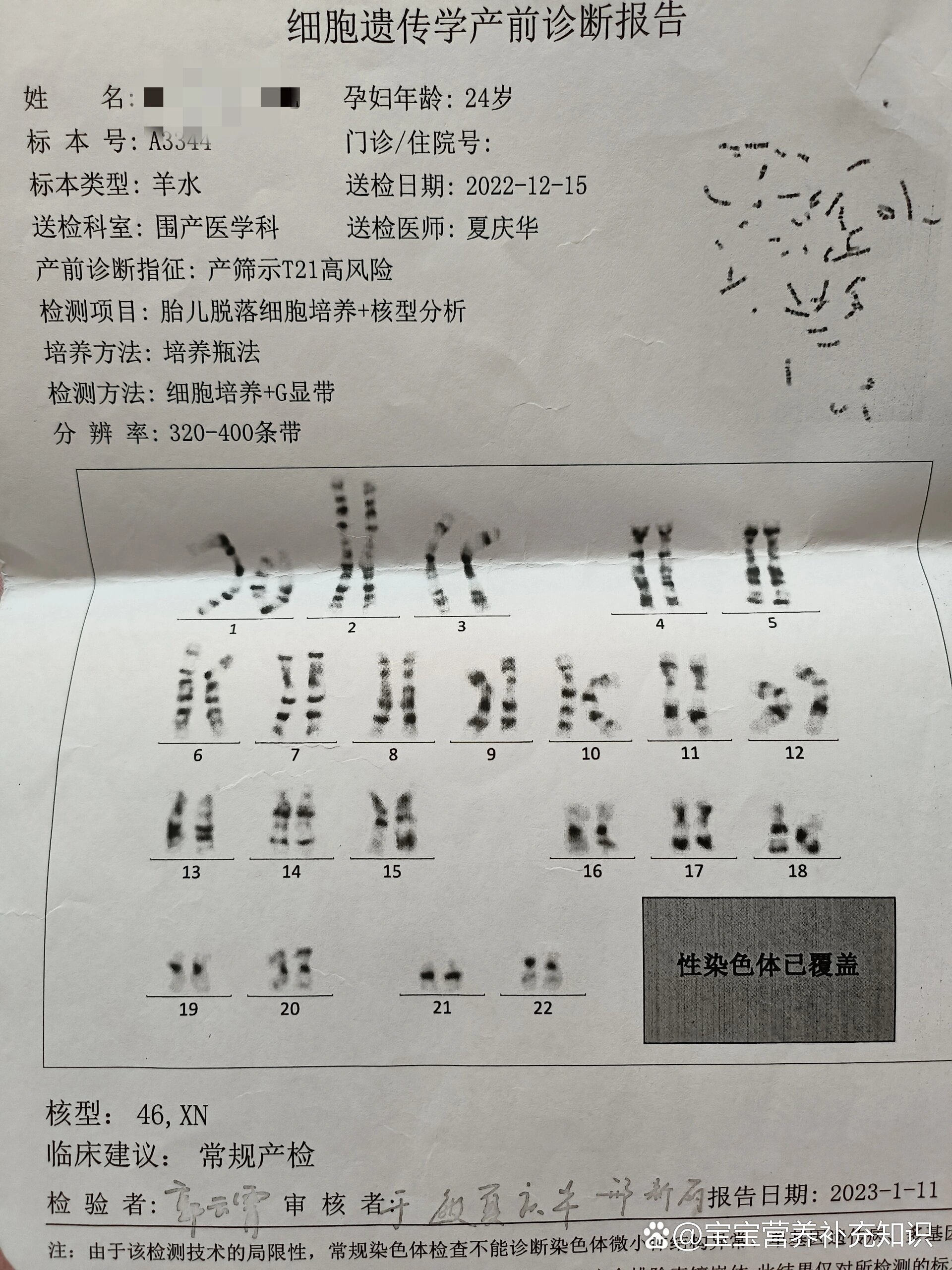 羊水穿刺检查