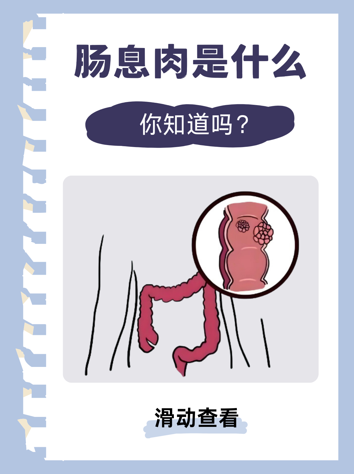 直肠息肉有什么症状