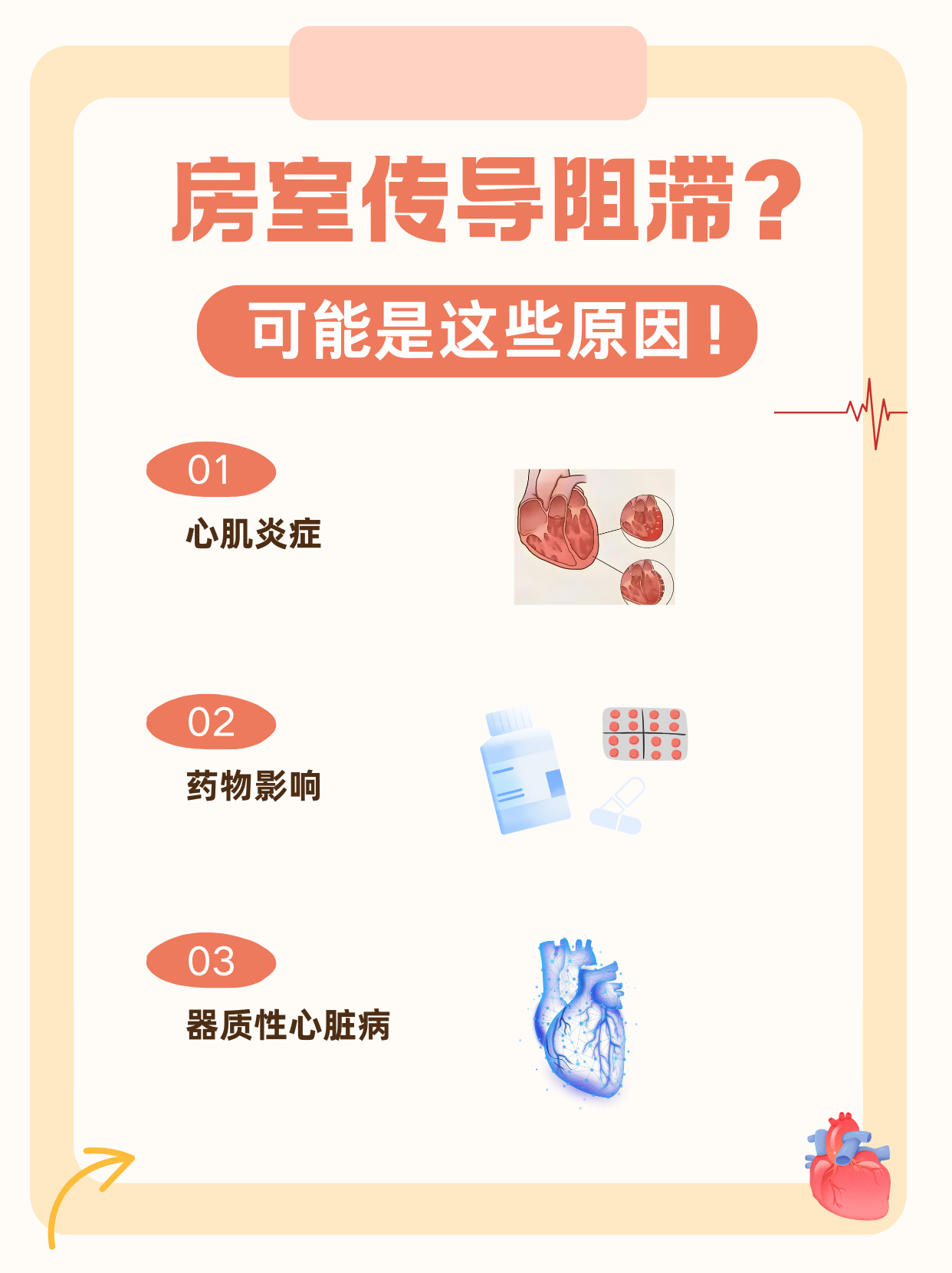 心脏二度传导阻滞,能治好吗