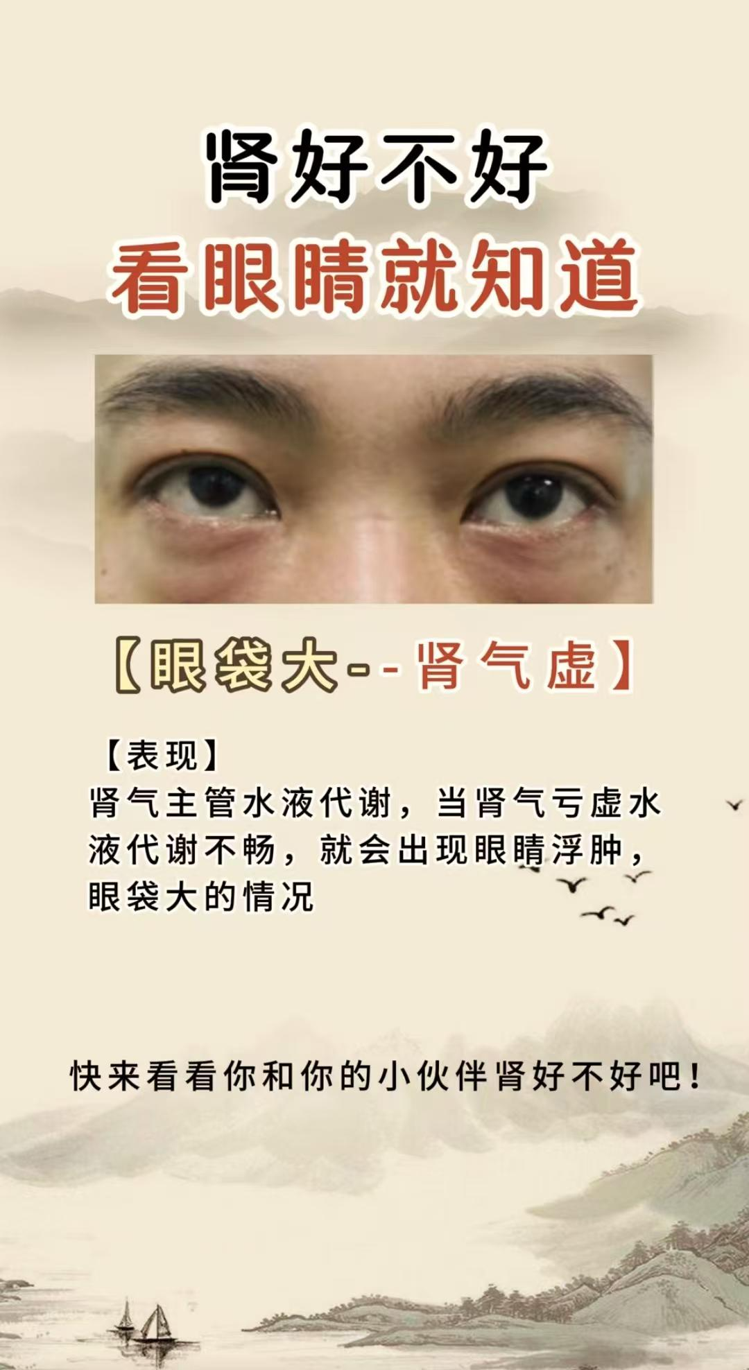 黑眼圈很重是什么原因