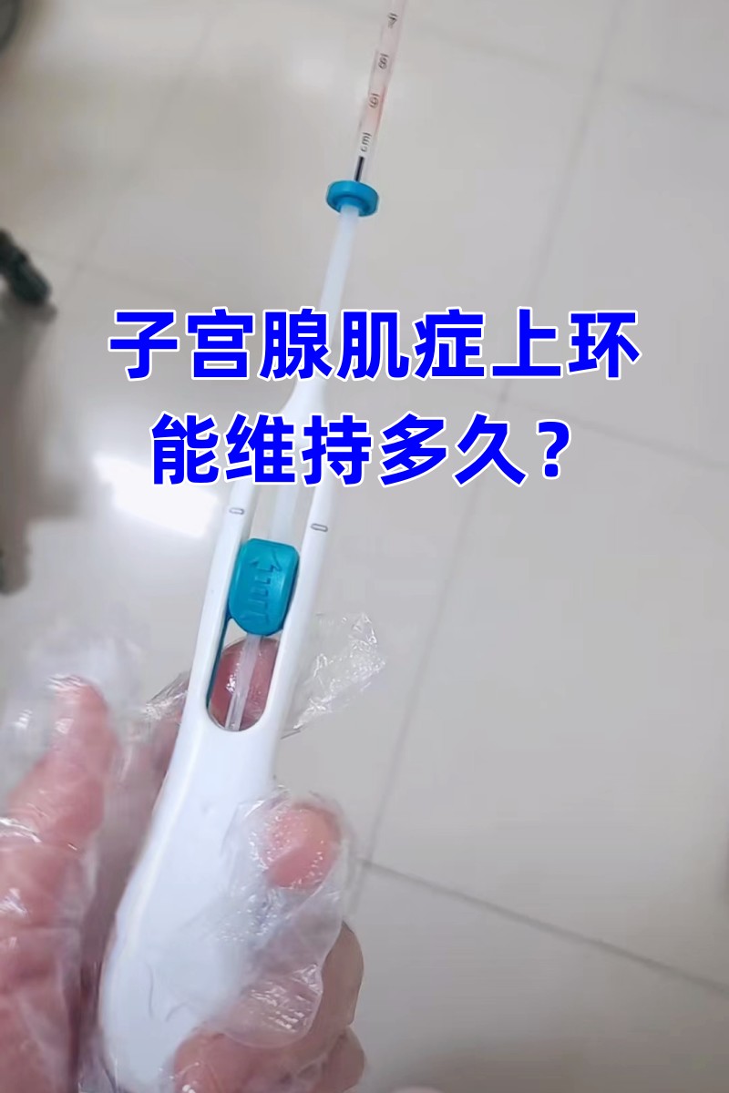 生孩子多久可以上环