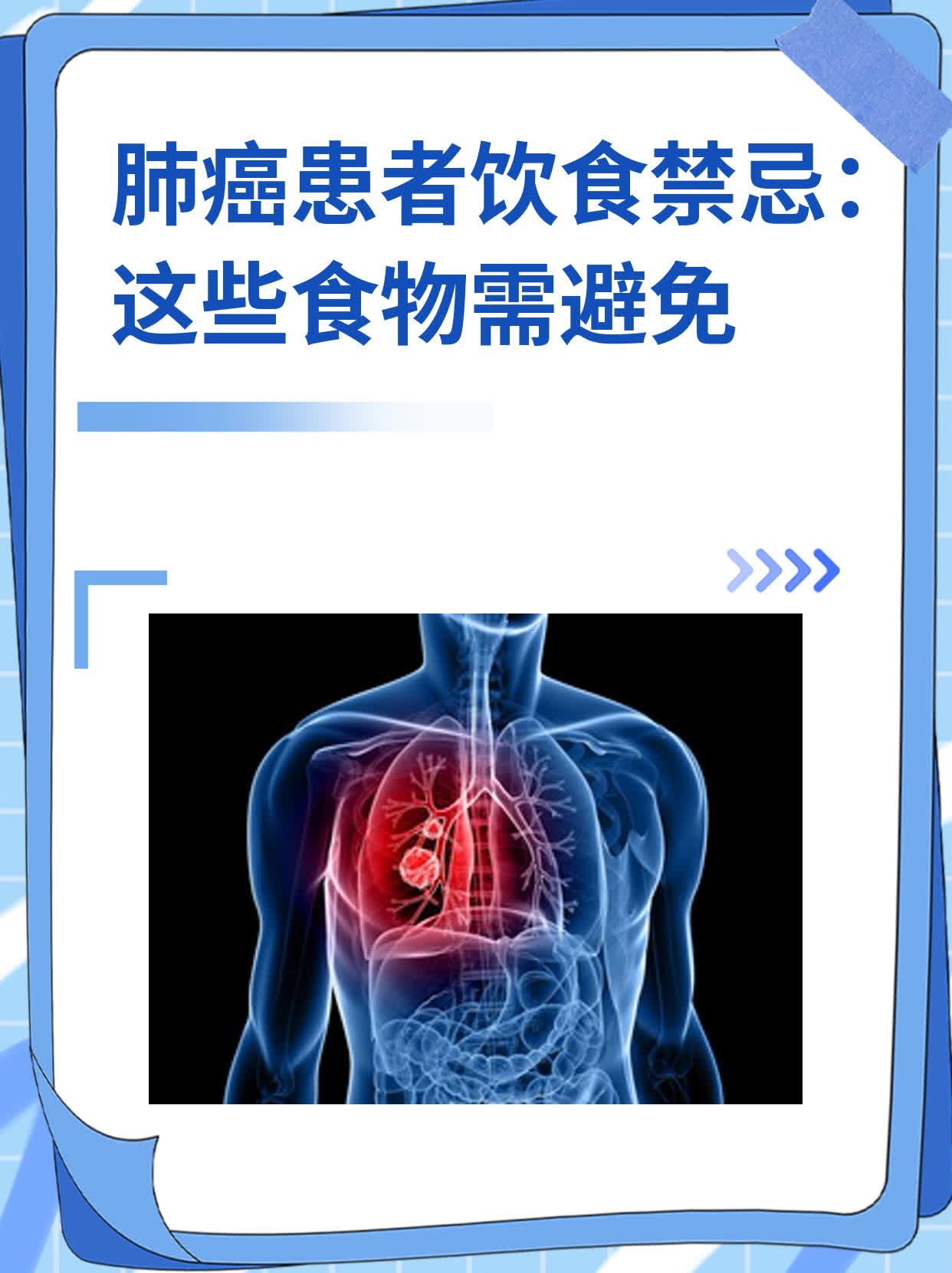 肺癌患者有哪些食物不能吃?