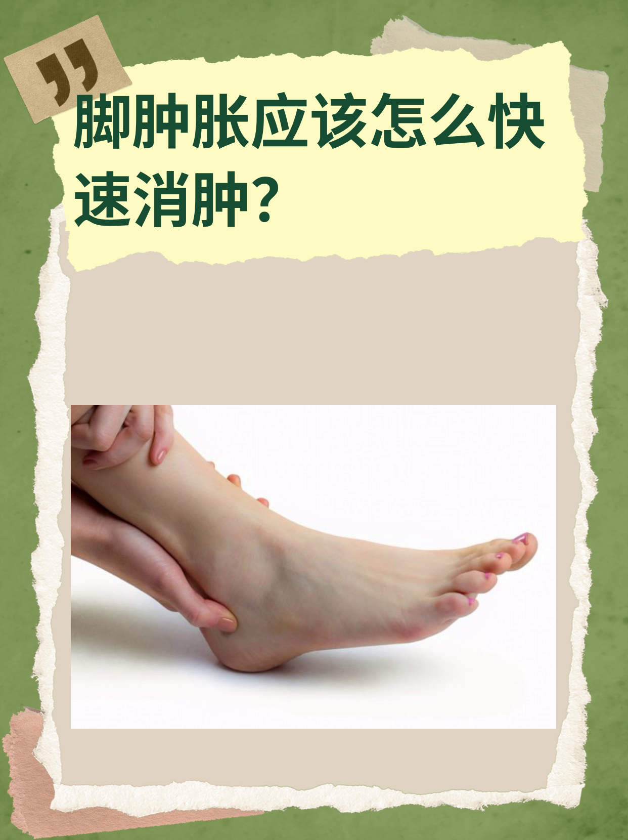 脚肿怎么办