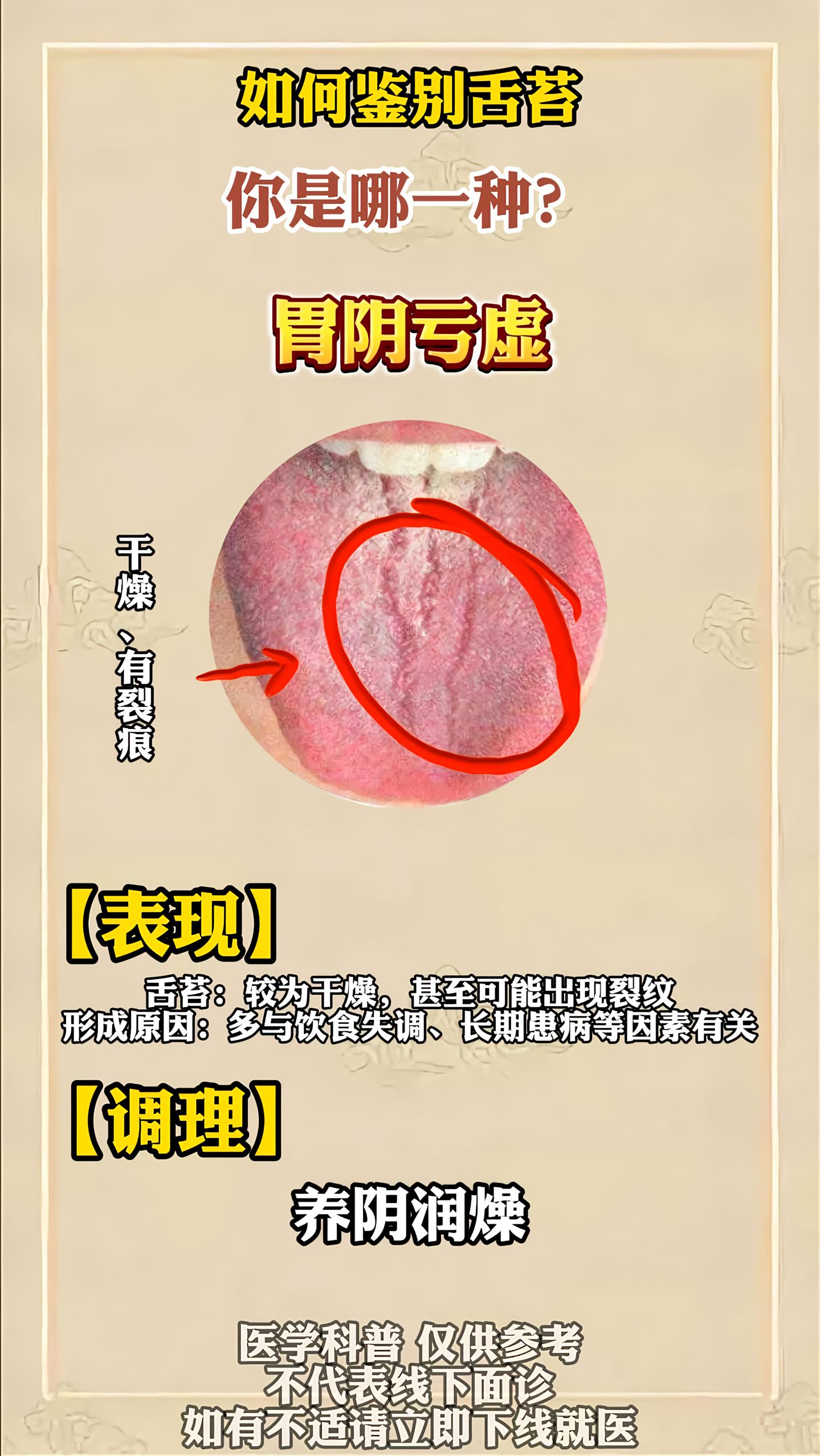 胃火旺的症状
