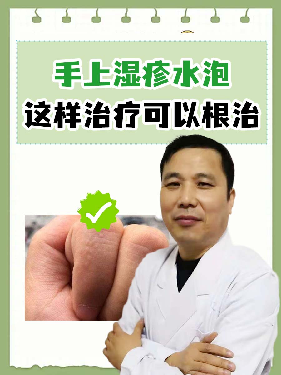 手上长小水泡怎么办