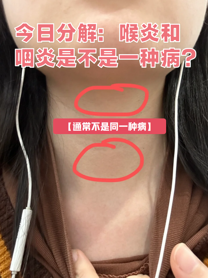 过敏性喉炎的症状有哪些