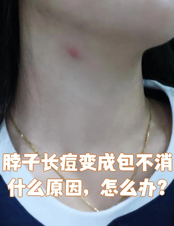 脖子上长了一个痘痘一样的