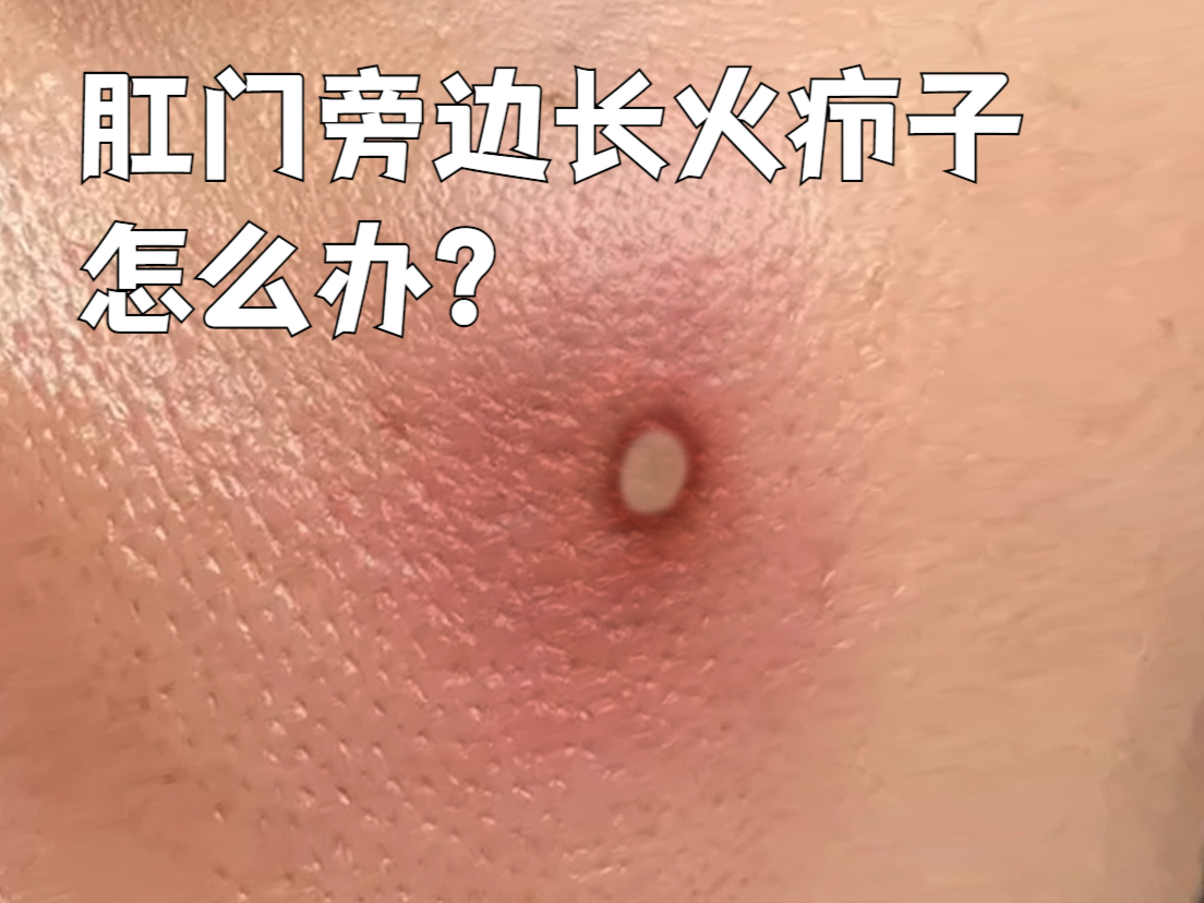 结子的治疗方法有哪些?