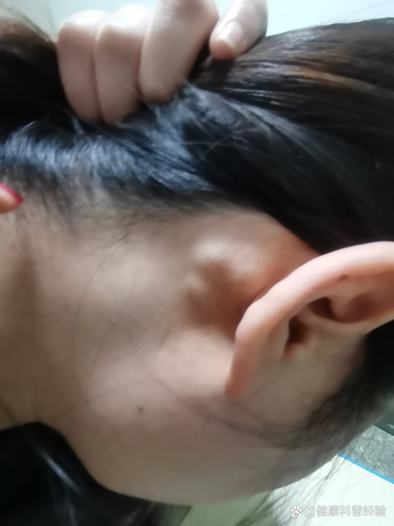 耳朵后面长了很多痘痘是怎么回事