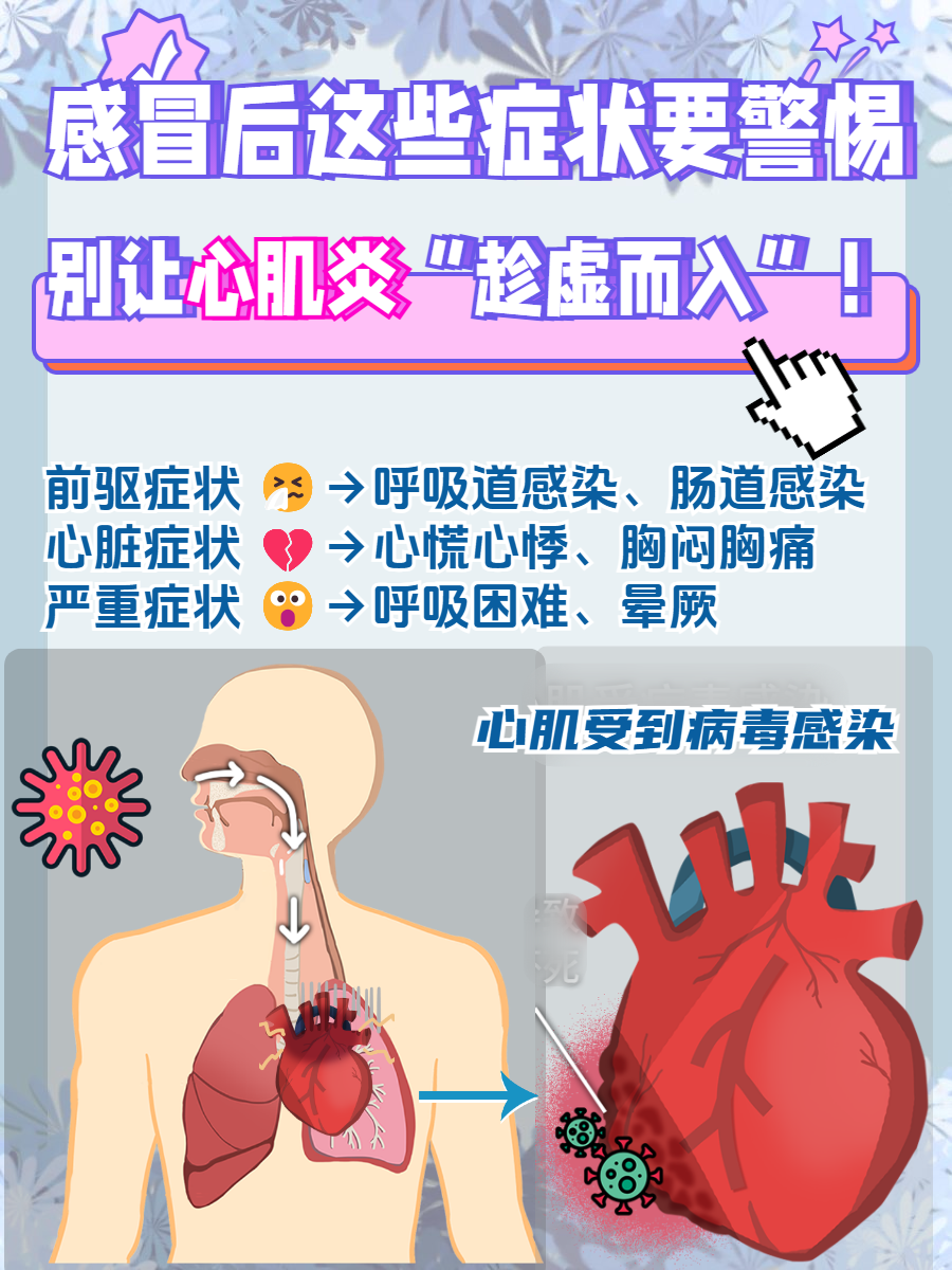 心肌炎是什么病严重吗