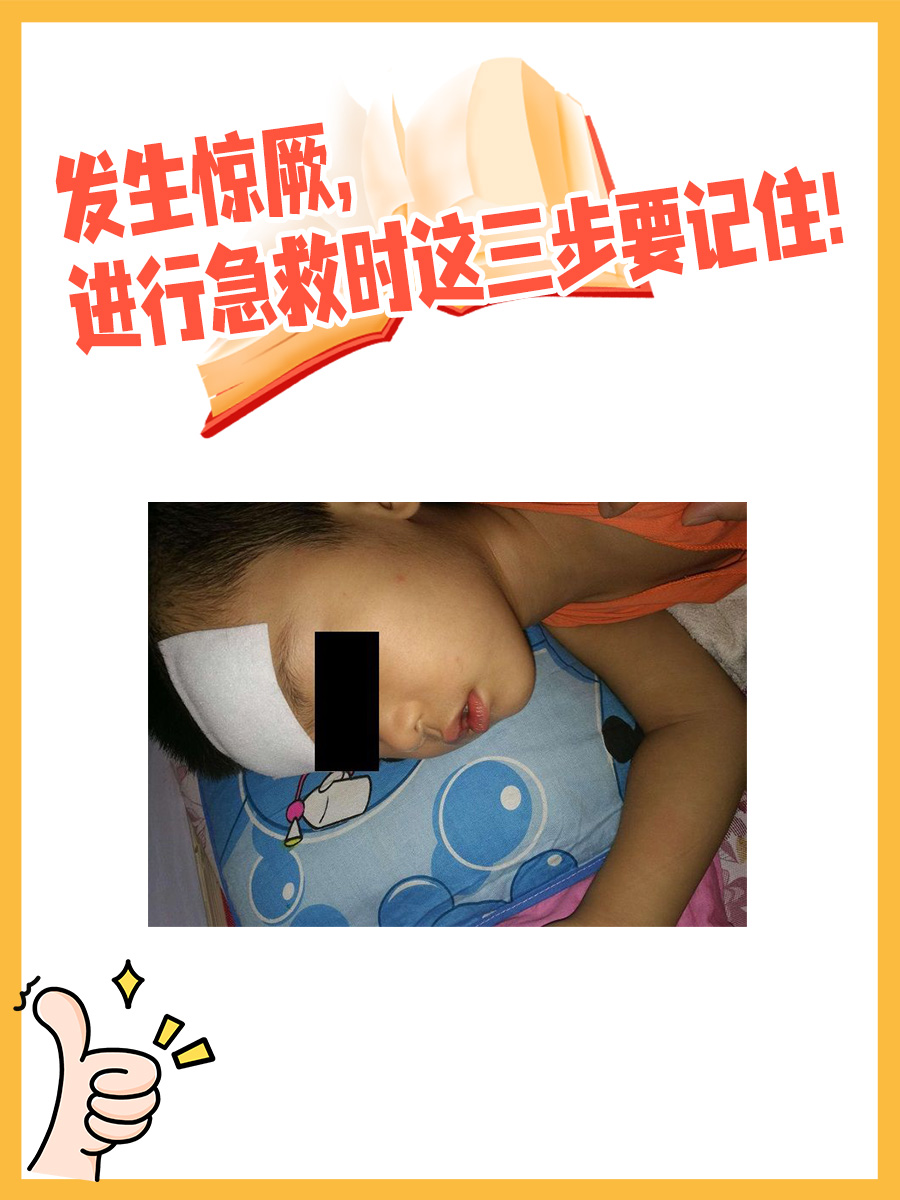 小儿惊厥的症状是什么