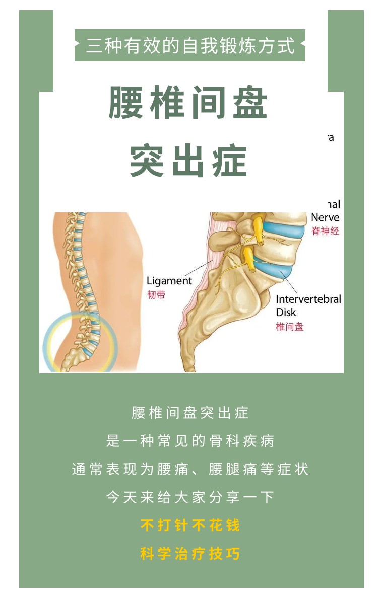 腰椎间盘突出的症状表现