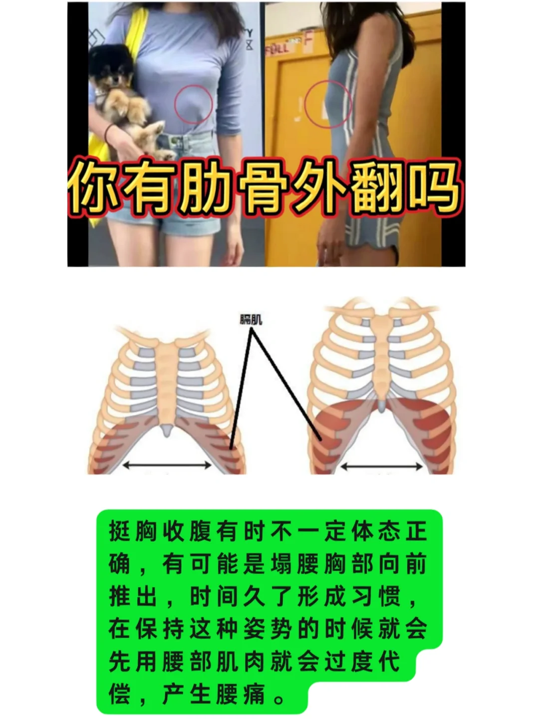 平躺肋骨凸出正常吗?
