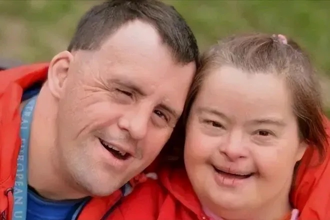 唐氏综合症是什么样子