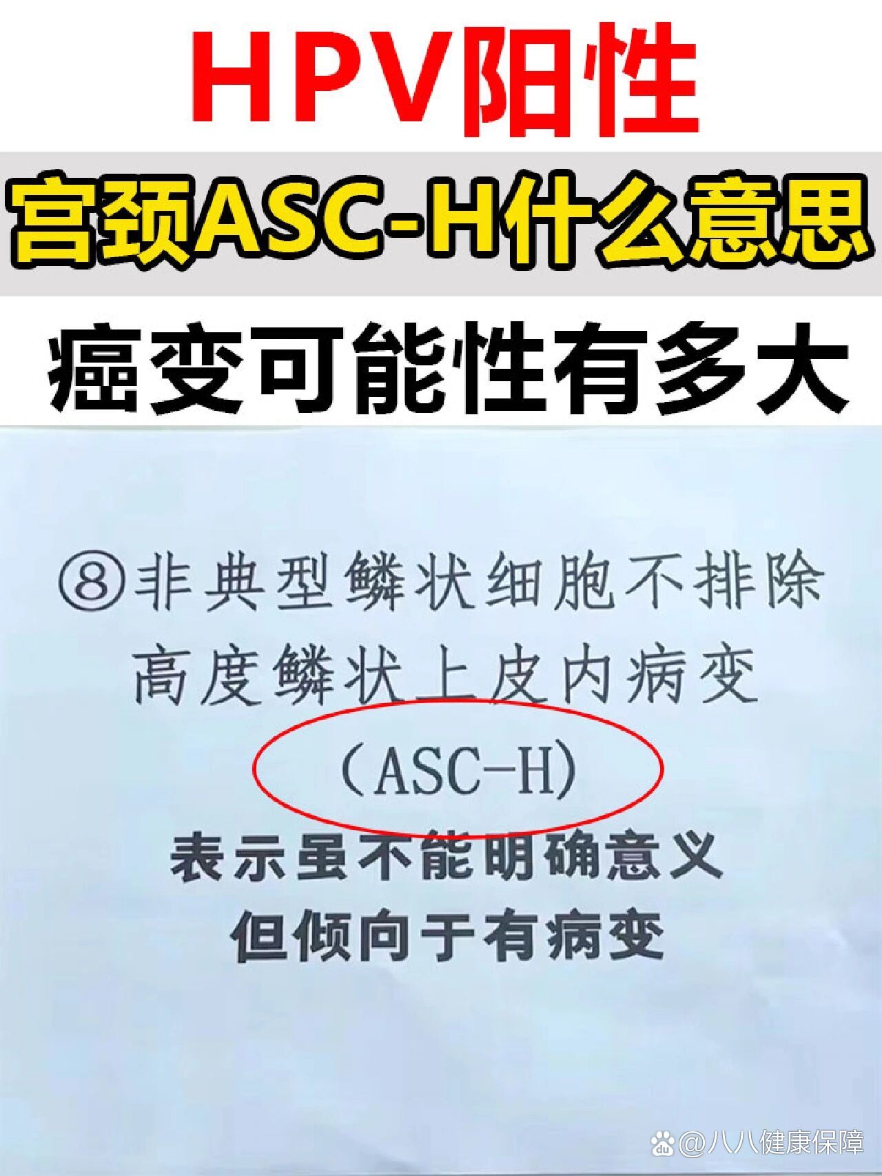 非典型鳞状细胞如何治疗