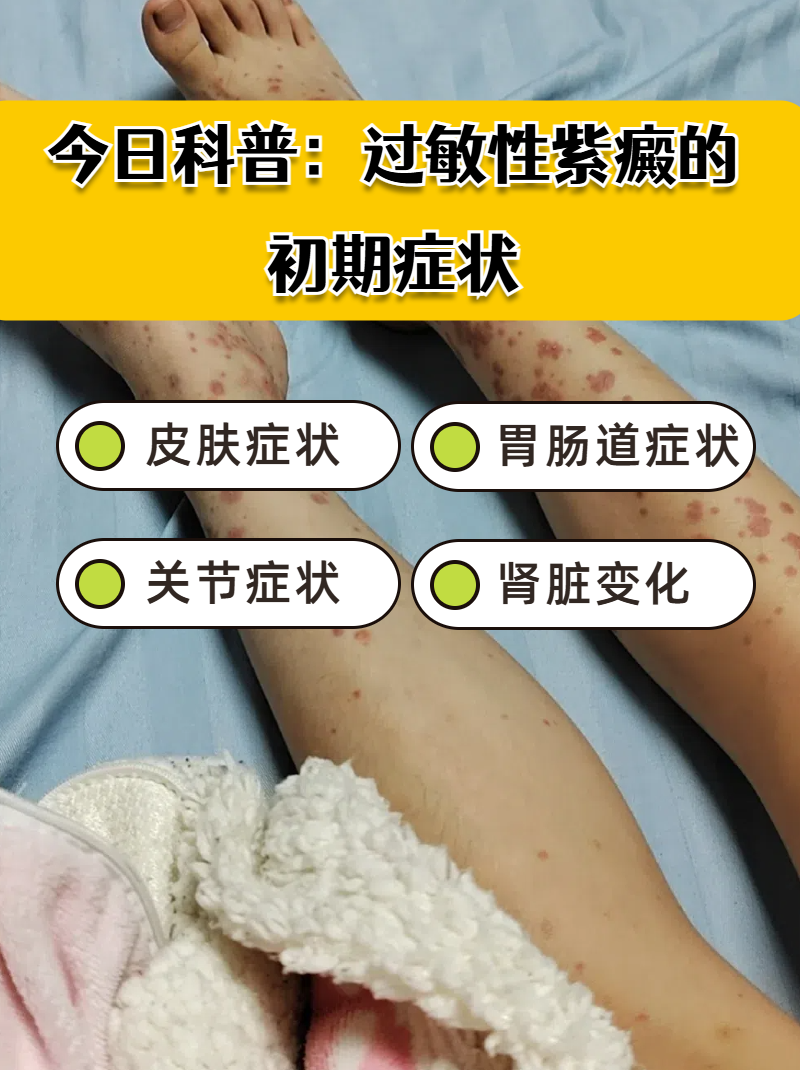 如何判断是不是紫癜