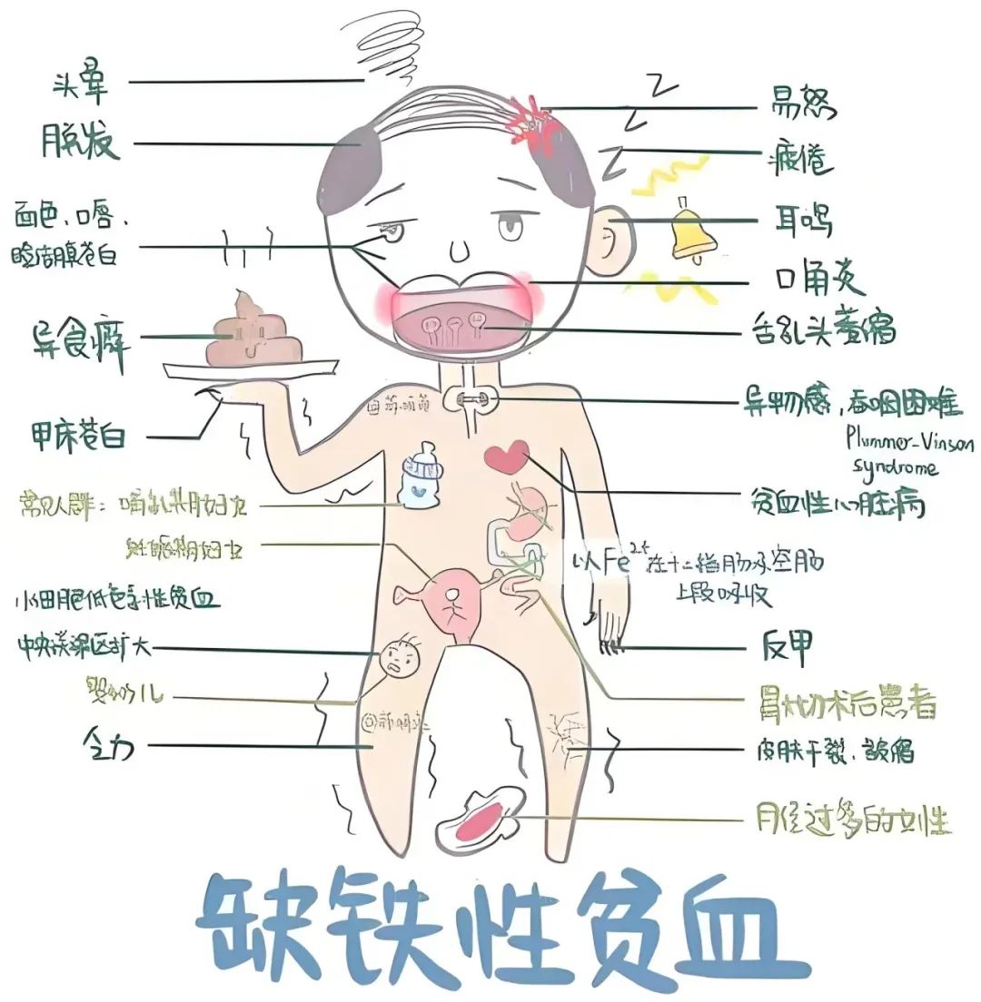 再生障碍性贫血存活率高吗
