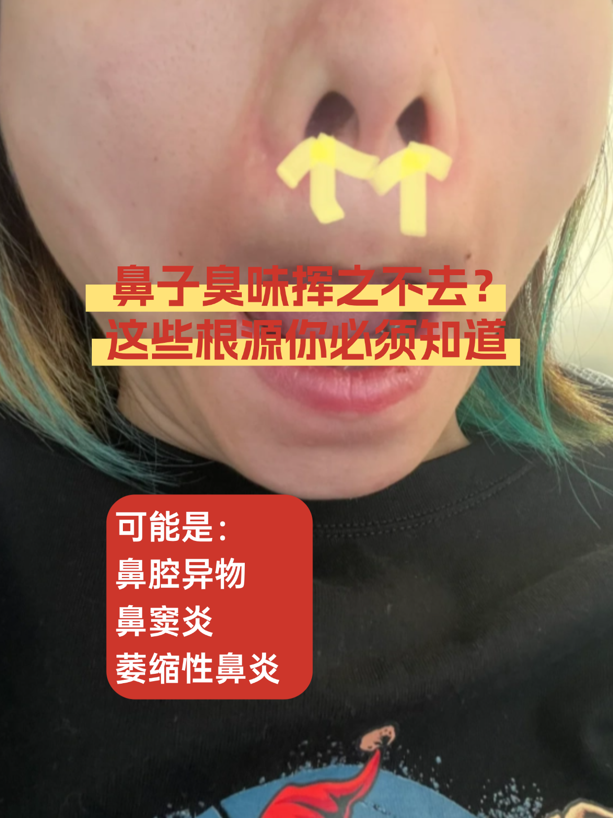 鼻屎臭怎么回事