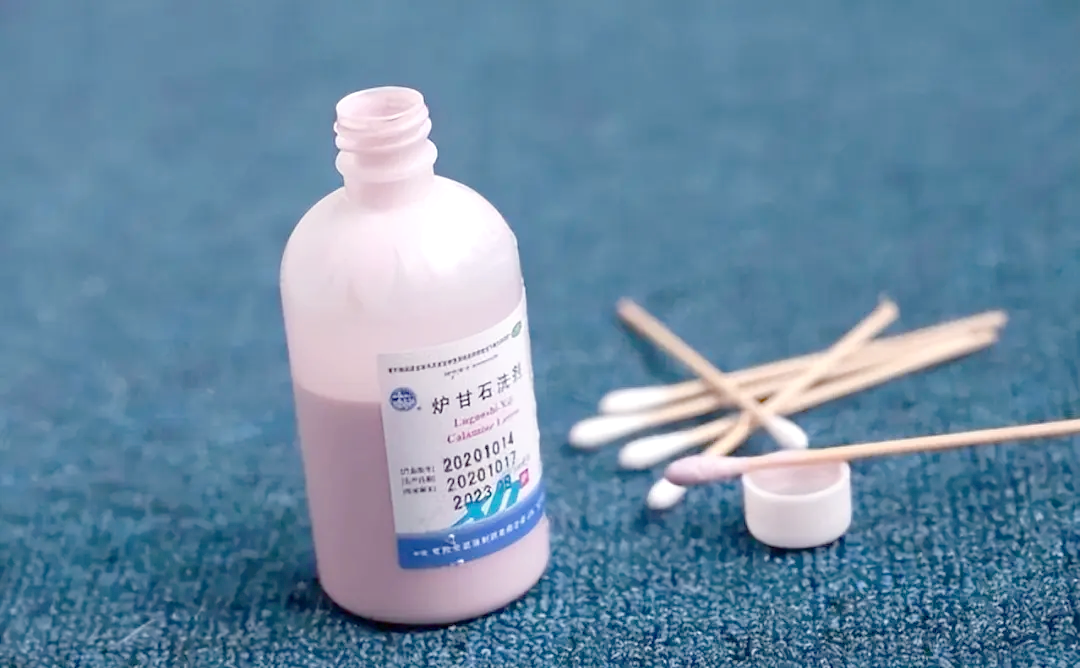 孕妇可以用炉甘石洗剂吗